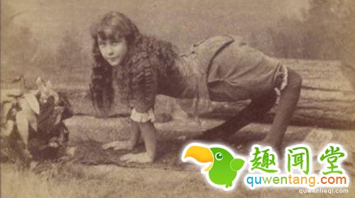 每10万人就有1人可能「只能像动物一样在地上爬」,努力用双脚走路的样子令人心疼...