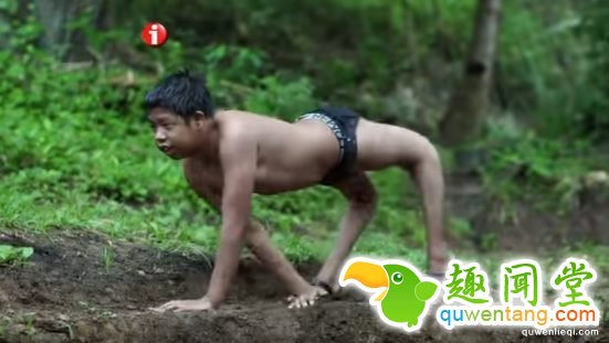 每10万人就有1人可能「只能像动物一样在地上爬」,努力用双脚走路的样子令人心疼...