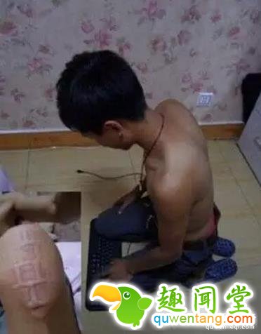 据说这都是得罪老婆的下场,实在没忍住~~